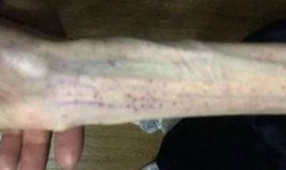 吃瓜四个月引产视频,吃瓜群众的真实见证